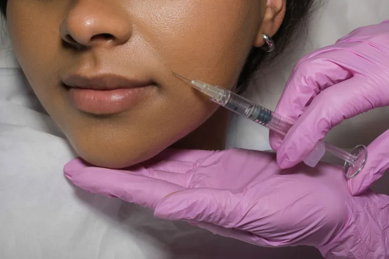 Enhance Your Natural Beauty with Dermal Fillers